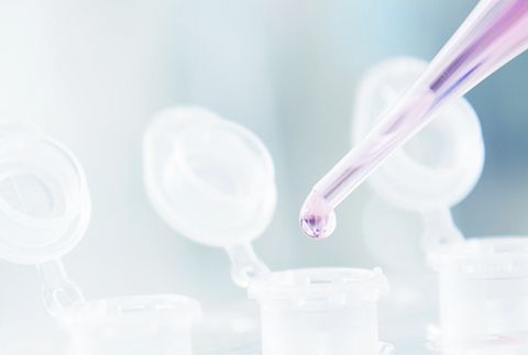 Methodenwechsel quantitative CMV PCR